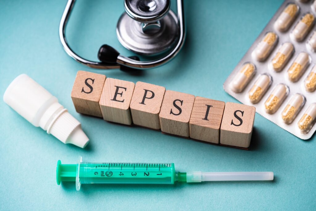 Sepsis nedir