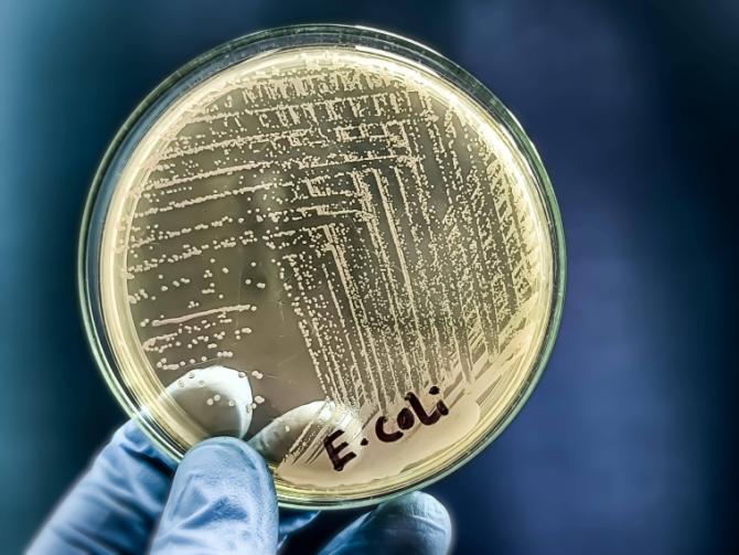 E. Coli (Koli Basili) Nedir, Belirtileri Nelerdir?